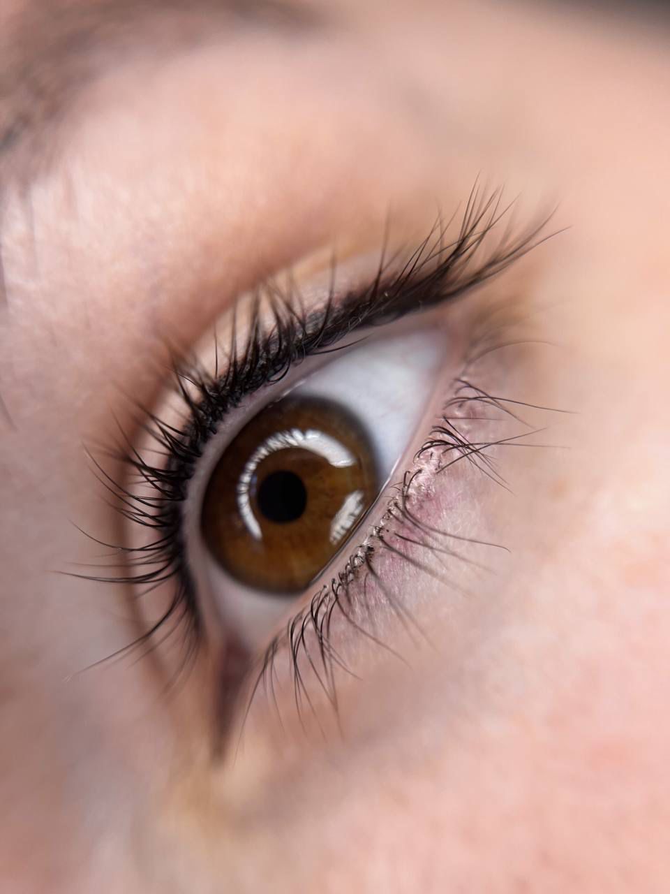 PMU Augen